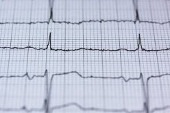 heart patients
