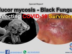 black fungus, mucormycosis, india, corona, covid-19