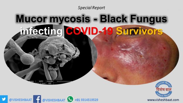 Mucormycosis Black fungus, a typically rare & hard-to-treat, potentially fatal fungal infection, ticking like a time bomb, adds to India's COVID woes